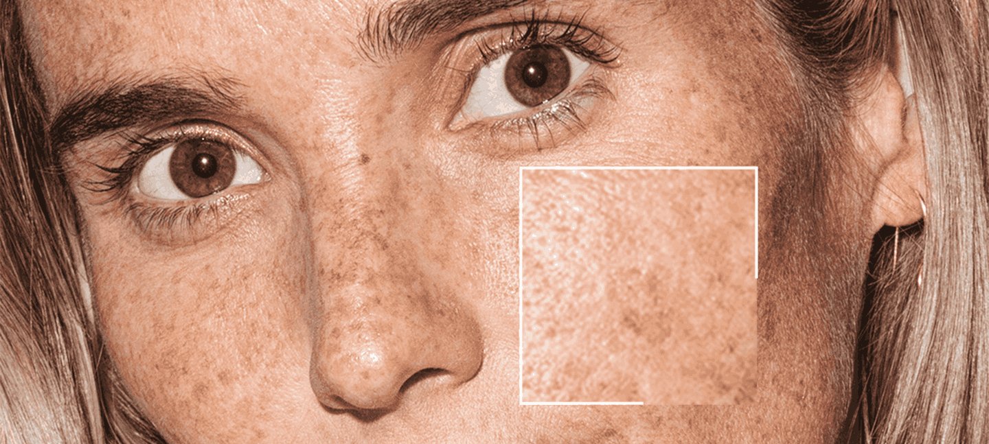 despigmentante facial